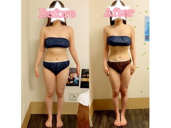 アスポーテ(ASBEAUTE)