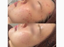 ファースト(1st)/