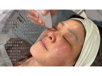 ミトノウ(MITONOU)/エアセラム 幹細胞美容液導入