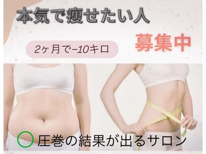 エステサロン ジュブリーの写真