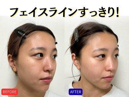 ナチュラルパーフェクトフェイス 新宿の写真