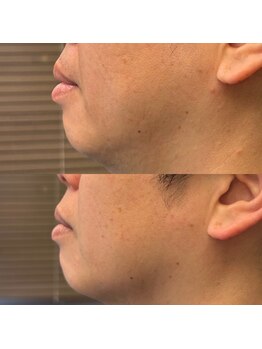 フェリーバ(FELIVA)/表情も爽やかになります♪