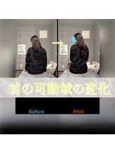 ニューステップ(New step)/首の回旋動作のbefore/after