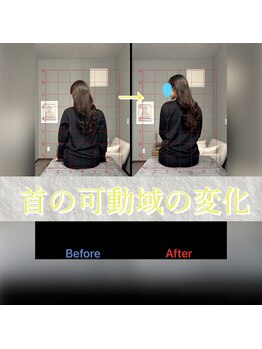 ニューステップ(New step)/首の回旋動作のbefore/after