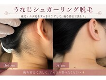 ベル(Belle)の雰囲気（うなじを整えて、後ろ姿に自信を♪ワキとVIOも人気パーツです♪）