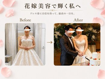 エステティックサロン サロン ド ヴィーナス 新宿店の写真/結婚式までに、もっと好きな私へ。