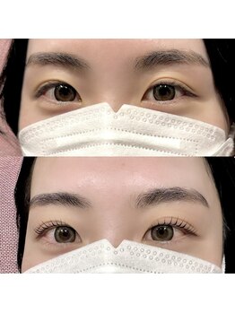 アイロ アイ(airo eye)/アップフォースリフト