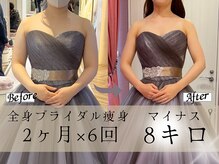 スリムプロ 天王寺店(Slimpro)の雰囲気（Before After写真1000件以上掲載中！効果に自信があります◎）
