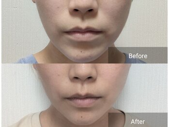 ネイル リリ(nail RiRi)/