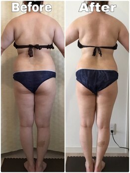 クリスタルビューティー/10回コース