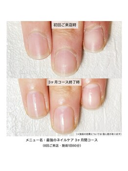 ネイルサロン ラピエトラ(la pietra)/最強のネイルケア3ケ月間コース