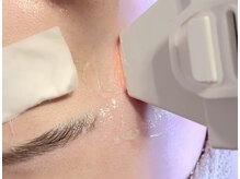 アユスパ(Ayu SPA)の雰囲気（極小ヘッドで【眉毛の細かなデザイン脱毛】も可能★）