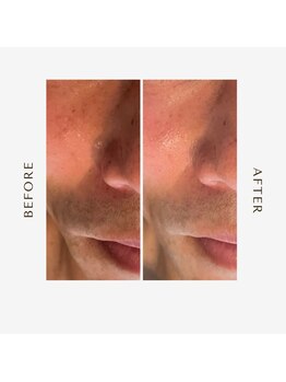 オーシャン(OCEAN)/before after