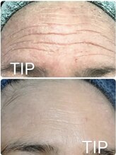 エル(Elle)/【肌改善】敏感肌/乾燥/シワケア