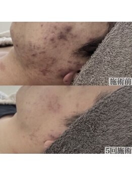 ヴェルシック(Belchic)/美肌になりたい方の最後の砦です