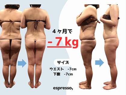 エスプレッソ(espresso,)の写真