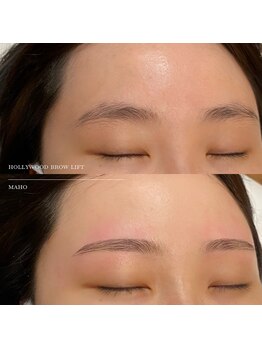 アタ(atha)/ハリウッドブロウリフト