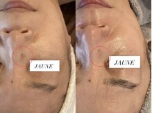 ジョーヌ(JAUNE)/