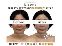 サロン ド ナース ユー ソナ(salon de nurse U.sona)