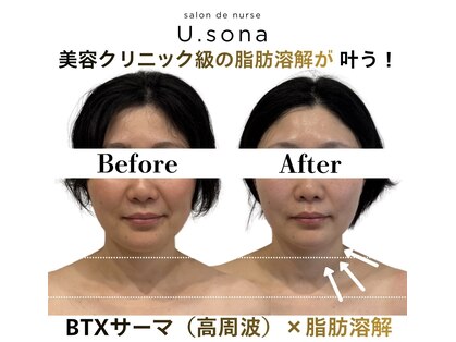 サロン ド ナース ユー ソナ(salon de nurse U.sona)の写真