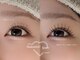 エピュレ(Epure)の写真