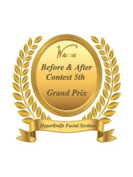 綺麗のひみつ/”5th”グランプリ受賞