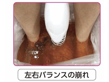 ローズ 下松(ROSE)/【末端の冷え・低体温・代謝低】