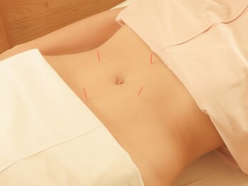 トーリ 代官山(taulli)/腹部の鍼【代官山/鍼灸】