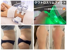 ラプンツェルサロン(Rapunzel salon)の雰囲気(脂肪冷却,オンダボディ&フェイス,クアトロ)