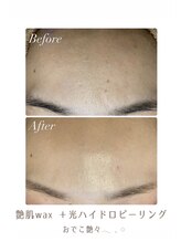 アリュール(ALLURE)/【艶肌waxの施術効果】