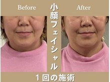 星ヶ丘整体NOA/小顔・.猫背骨盤矯正付き