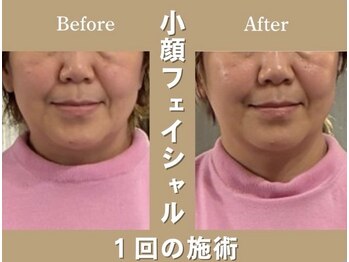 星ヶ丘整体NOA/小顔・.猫背骨盤矯正付き