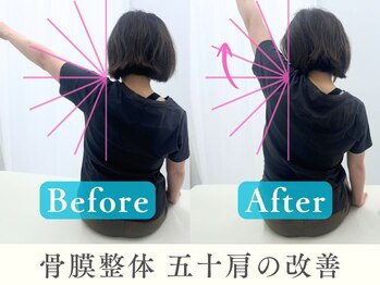 ヒラメント 浜松町(Hilament)/ビフォーアフター:肩の可動域