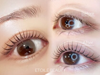 エトワールビューティー(ETOILE BEAUTY)の写真