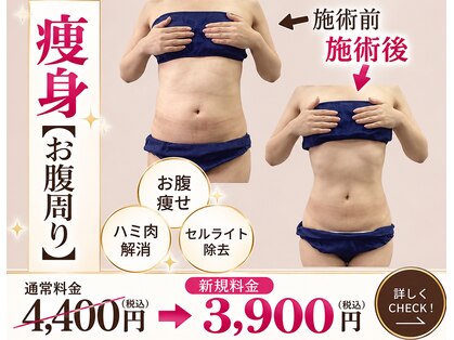 キュララ(KYURARA)の写真