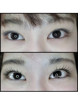 リリウム(Lilium)/