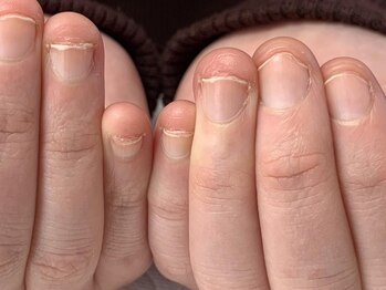 トッコネイル(tocconail)の写真/『えっ？！自分の爪じゃないみたい♪』爪にコンプレックスをお待ちの方も、爪育で自分史上最高の美爪へ