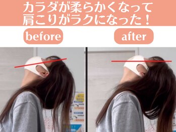 整体院 ひなどり/肩こりがラクになりました!