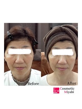 コスメティック雅/【透明感アップ】