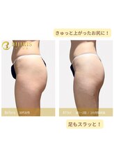 キングスサロン 熊本/ボディの変化も身体の変化も！