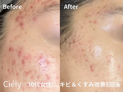 シエリー 原宿本店(Ciely)の写真