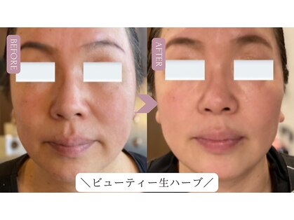 サロンドプッチイ(SalondoPutti)の写真
