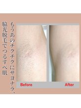 ミル(milu)/見せたくなる脇肌、光でつるすべ