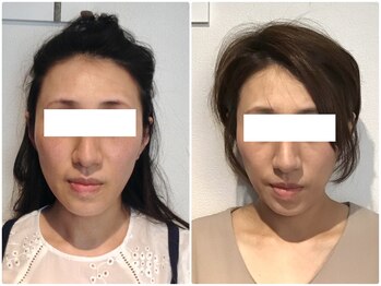 美容整体ウェリナ 名駅院/小顔矯正/骨盤矯正/美脚サロン