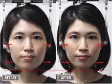 さつま骨格矯正 表参道青山院/歪み小顔矯正＋骨盤矯正