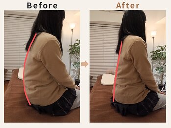 ハリデイズ/10代-姿勢改善、むくみ