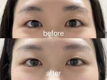 シエナ アイ(CIENA eye)/