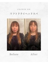 サロンドソエ(Salon de Soe)/小顔ドライヘッドスパ+耳つぼ