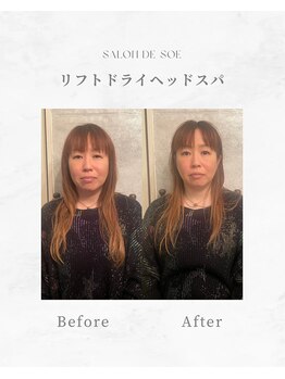 サロンドソエ(Salon de Soe)/小顔ドライヘッドスパ+耳つぼ