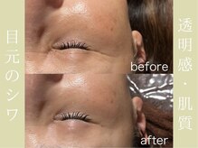 健志接骨院/πテラピー造顔メソッド